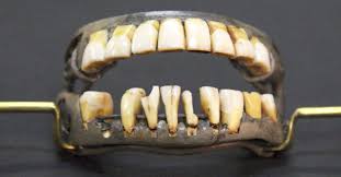 Washington wore dentures throughout his entire presidency. Did George Washington Have Wooden Teeth