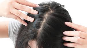What's left of it, at least. Knowing Your Bald Spot Treatment Options Toppik Hair Blog