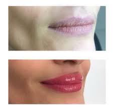 semi permanent lip treatments liverpool