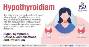 hypothyroidism symptoms causes