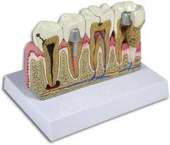 Dental Patient Education Materials Increase Case Acceptance