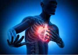 Vídeo ilustrativo sobre o infarto agudo do miocárdio (iam), conhecido popularmente como infarto do coração, enfarte ou ataque cardíaco, é uma doença que. Infarto Agudo De Miocardio En Personas Jovenes Articulos Intramed