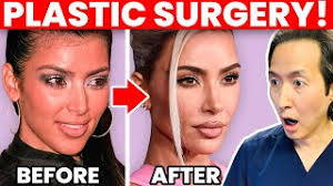 kim kardashian plastic surgery