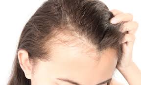 common scalp conditions pictures