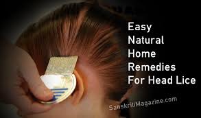 natural home remes for head lice