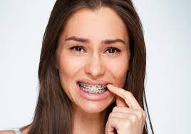 People who are getting braces soon or are considering them may wonder whether they hurt. Ways To Ease Braces Pain Omar Orthodontics
