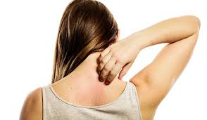 6 remes to stop rashes from