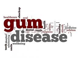 treating gum disease in our office and