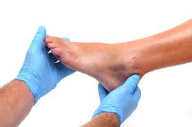 can an ankle sprain heal on its own