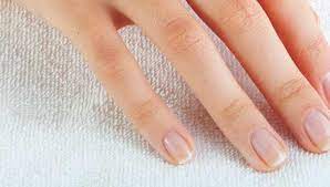 white spots on the nails causeore