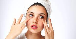 how to handle dry skin under your eyes