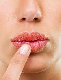 5 best chapped lips tips give your