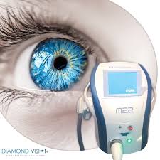 ipl therapy for dry eyes