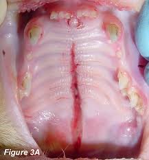 con cleft palate