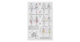 Sclerotome Visceral Pain Referral Chart Zazzle Com