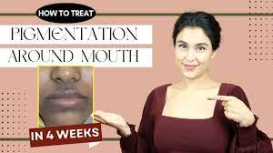 how to treat pigmentation around mouth