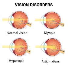 vitreous retina macula consultants