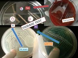 oxidase test principle procedure