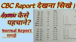 A cbc test usually includes: Cbc Blood Test Kya Hota Hai Cbc Blood Test Cbc Blood Test Report In Hindi Youtube