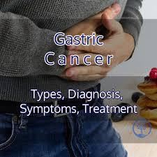gastric stomach cancer types