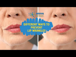 how to get rid of lip lines wrinkles