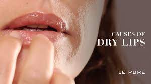 causes of dry and chapped lips le