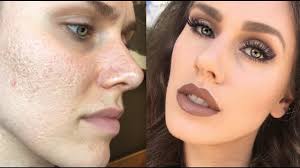 non comedogenic primers for acne e skin