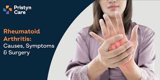 rheumatoid arthritis causes symptoms