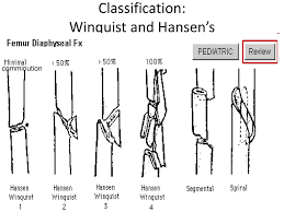 Winquist and hansen classification, usually abbreviated by the name of the first author, divides fractures of femoral shaft into four grades 07.08.2018 · the winquist & hansen classification is a system based on the extent of comminution and the amount of cortical contact between the fractured. Fracture Of Shaft Of Femur Ppt Download