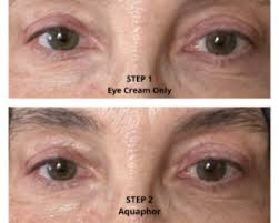 under eye skin 5 steps to taming and