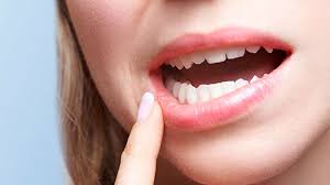 swollen gums possible causes and