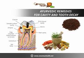 ayurvedic remes for cavity and tooth