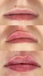 russian lip technique lip