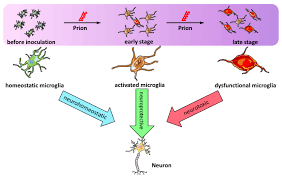 neuroinflammation in prion disease