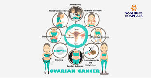 Most symptoms associated with ovarian cancer such as other classiﬁcation technique to guarantee the highest classiﬁcation performance. Ovarian Cancer Early Signs Detection And Treatment