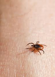 6 ways to remove a tick head after the
