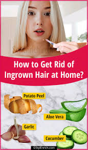 home remes for ingrown hair at home