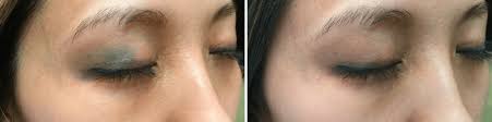 permanent makeup removal new jersey