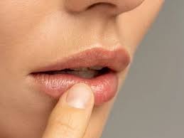what is the real cause of itchy lips