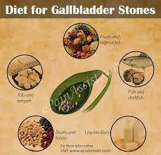 t for gallbladder stones foods to