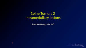 spine tumors 2 intramedullary lesions