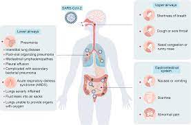 microbiota of patients with covid 19