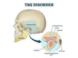 tmj disorder sound dental