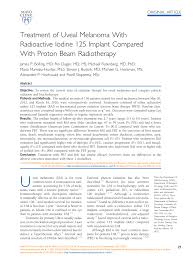 radioactive iodine 125 implant