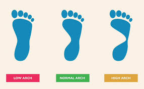 The term flat feet applies to the arch which is sitting on the ground completely. Know Your Arch Type Gotham Footcare Podiatrists
