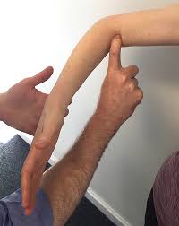 biceps ruptures yorkshire shoulder clinic