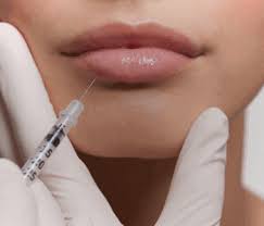 how to reduce swelling after lip fillers