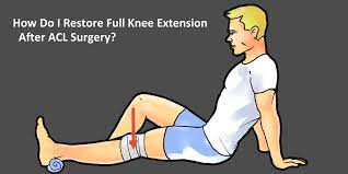 full knee extension after acl surgery