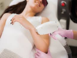 ipl laser hair removal in singapore