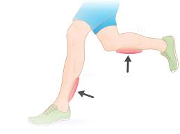 calf pain and shin splints after running